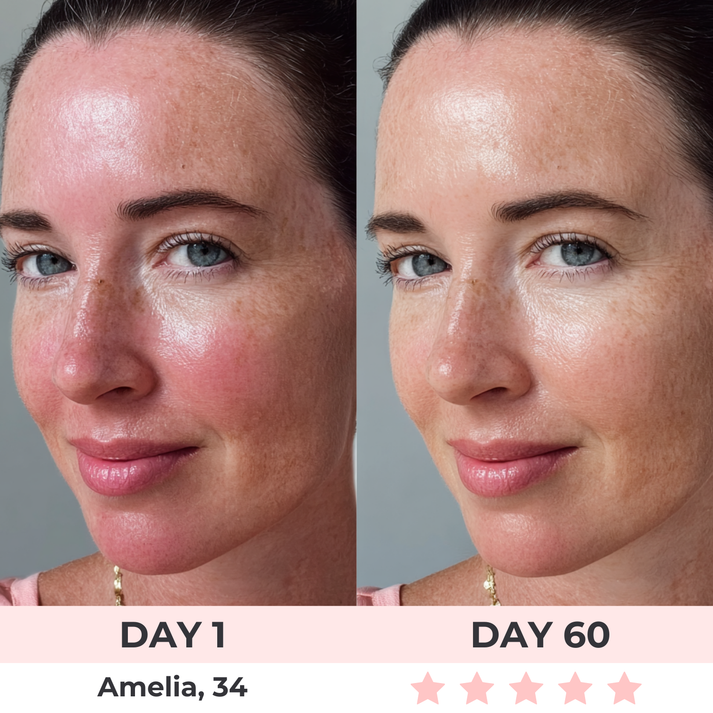 Shopseras™ - LED Face Mask